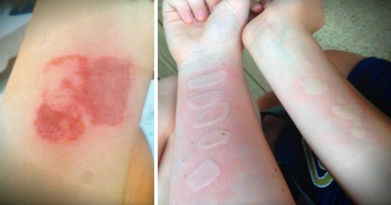 «Salt and Ice Challenge» – Το νέο Διαδικτυακό φαινόμενο