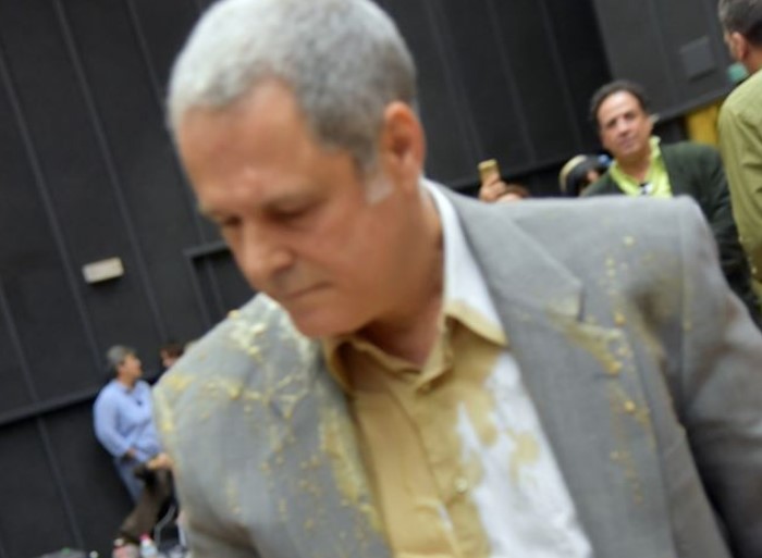 Τα πειστήρια του Τζήμερου από τον εκσφενδονισμό της «φλυτζάνας» στο πουκάμισό του – Φωτογραφία