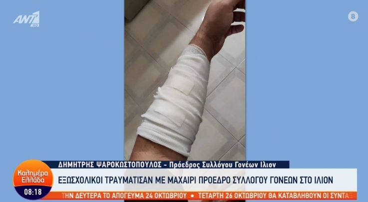 Ίλιον: Εξωσχολικοί τραυμάτισαν με μαχαίρι πρόεδρο του συλλόγου γονέων επειδή τους έκανε… παρατήρηση (Βίντεο)
