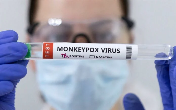 Ιός mpox: Ανάστατος ο ΠΟΥ, προειδοποιεί για αύξηση κρουσμάτων στην Ευρώπη – Ποιοι πρέπει να προσέχουν, τα συμπτώματα
