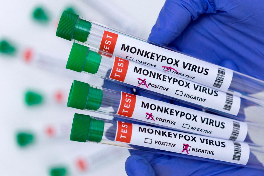 Συναγερμός για τον ιό mpox – Εντοπίστηκε το πρώτο κρούσμα στην Ευρώπη – Τα συμπτώματα