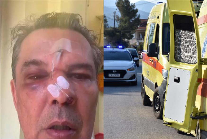 Χαϊδάρι: «Του είπα να μιλά πιο σιγά και με πλάκωσε στο ξύλο» – Καταγγελία για άγριο ξυλοδαρμό σε ιατρείο